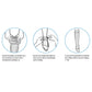 EdemaWear® Compression Stockinette 1/pair